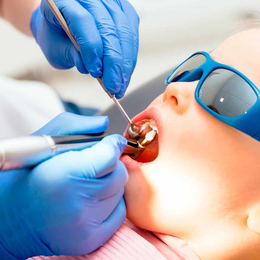 caries en niños