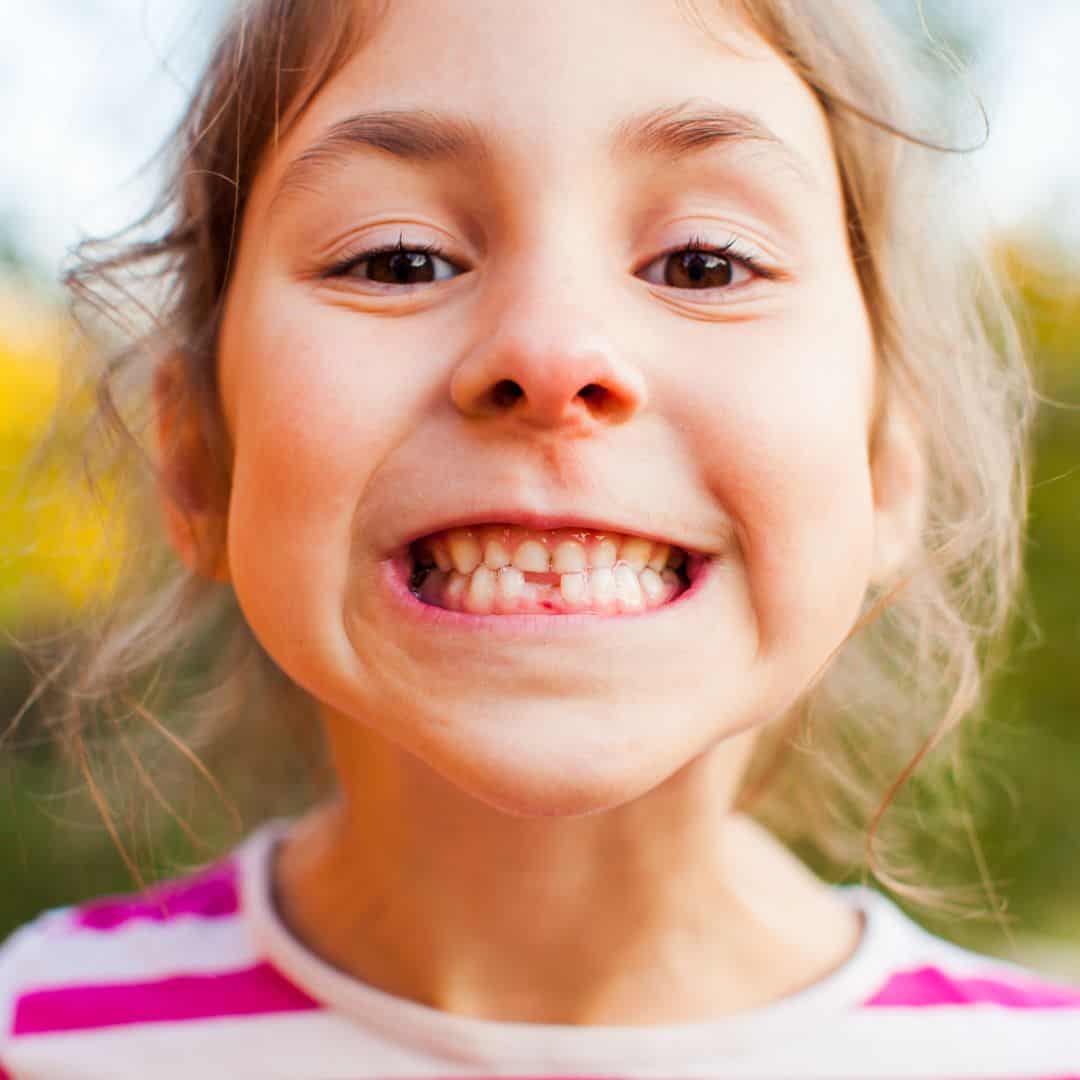Dentista para niños