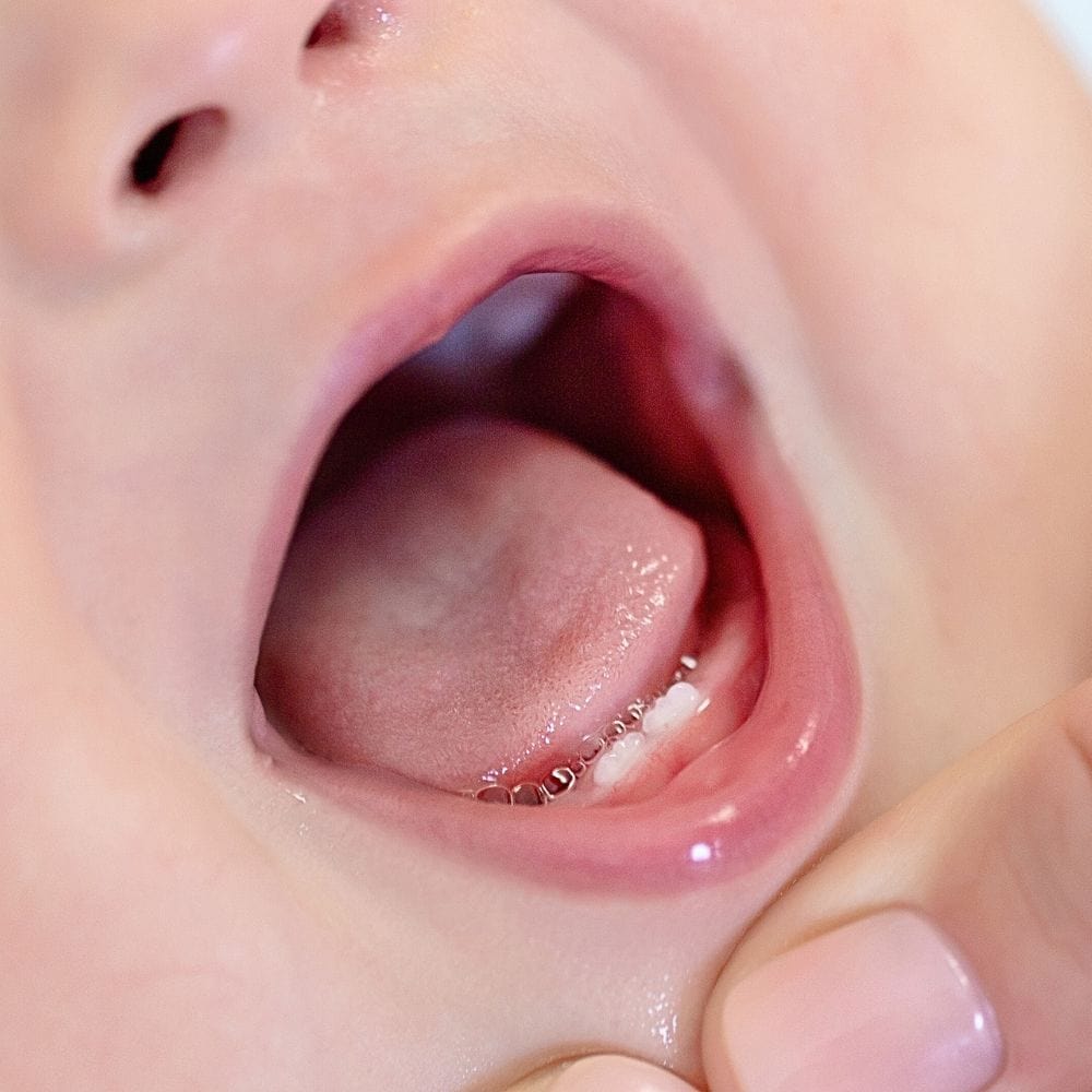 Dentista para niños