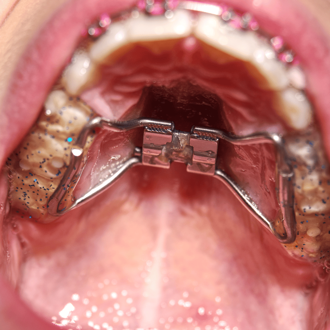 Odontopediatría