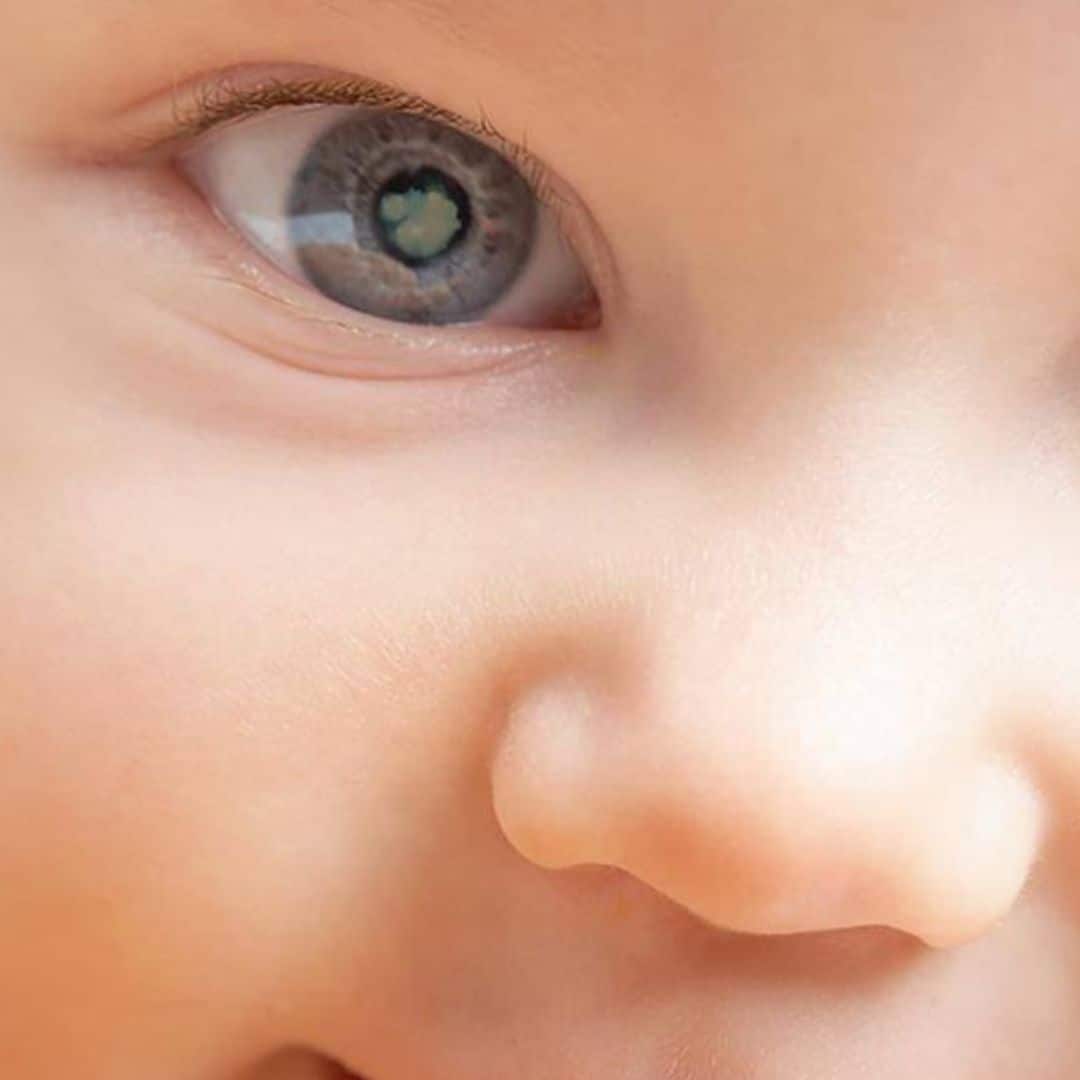 Oftalmología pediátrica