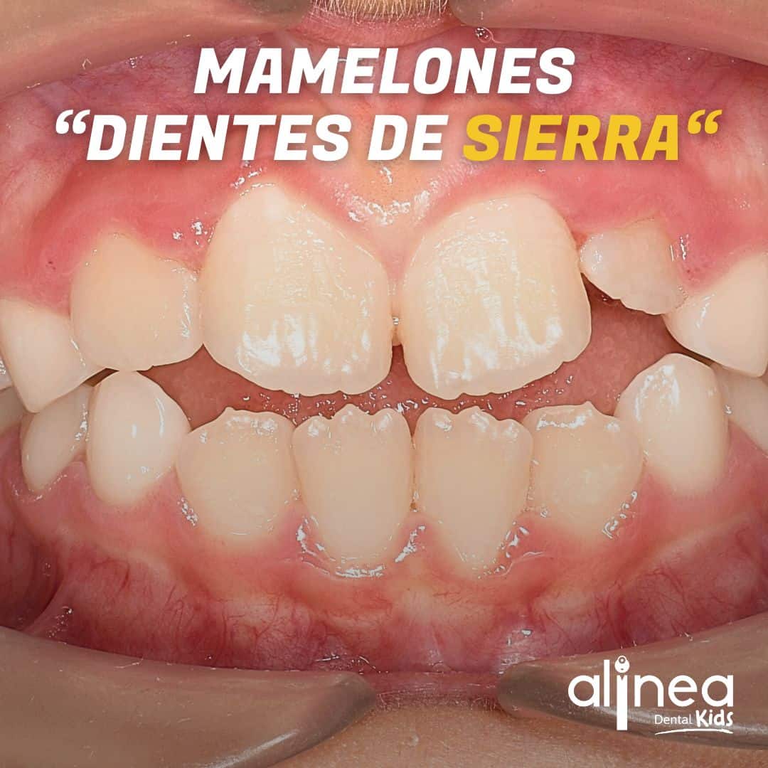 Dentista para niños