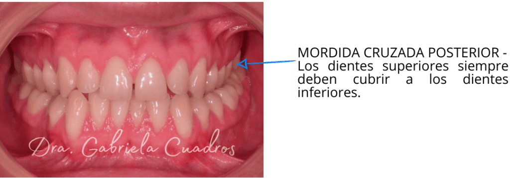 Caso Alinea