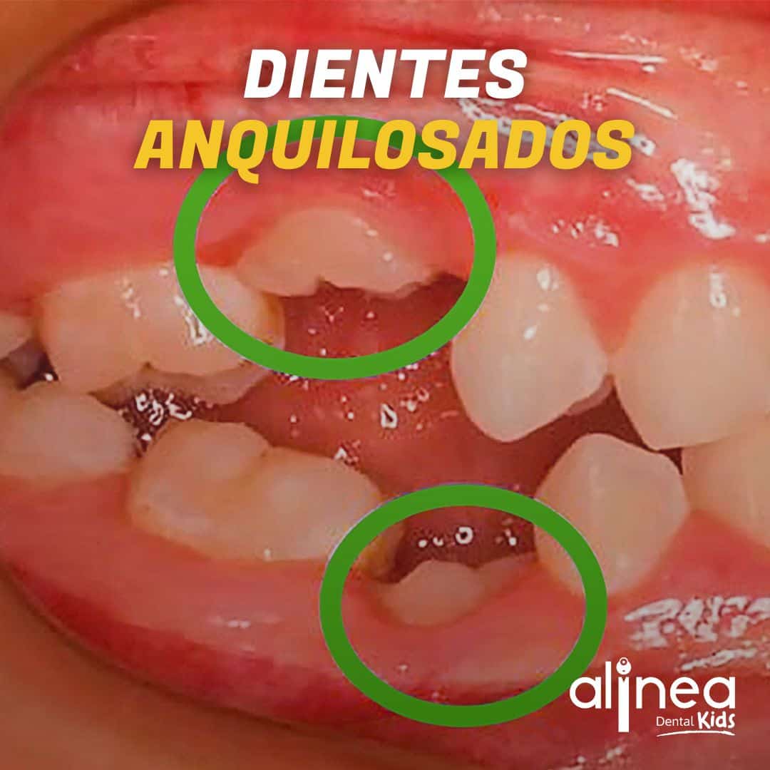 Dentista para niños