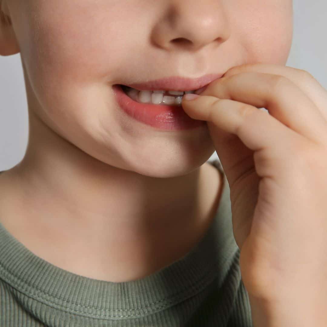 Odontopediatría