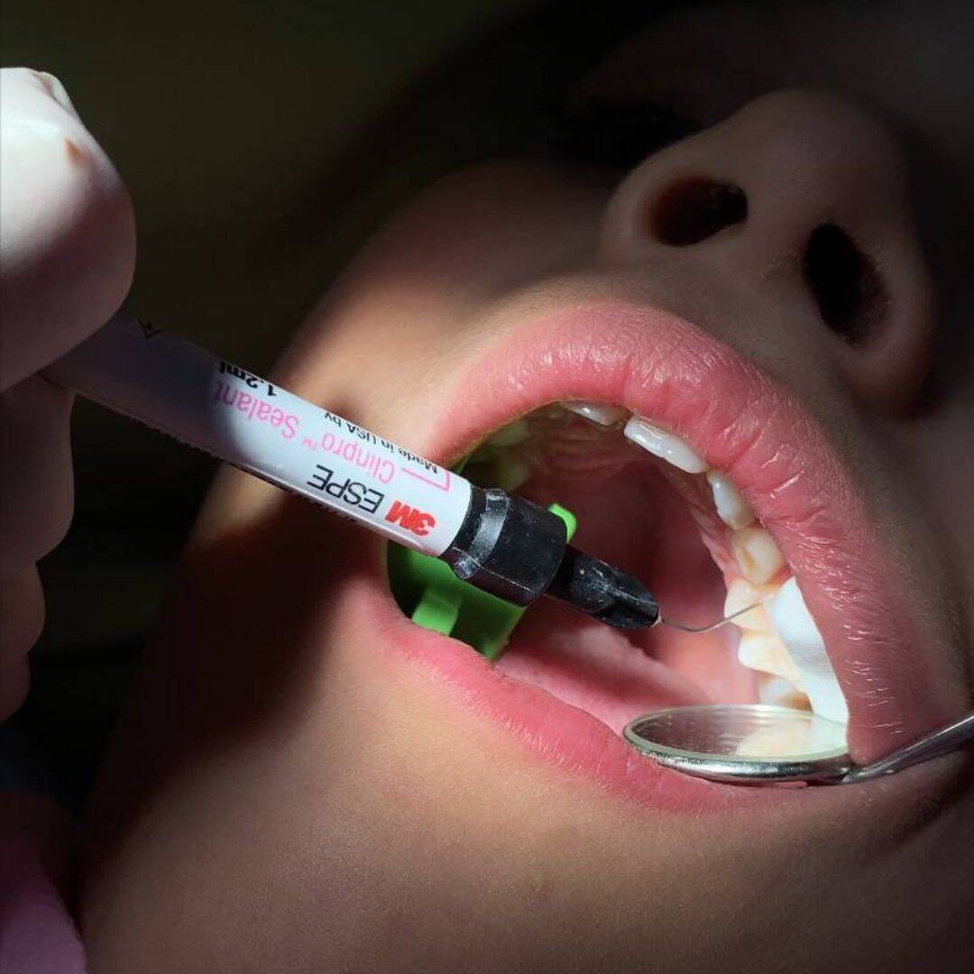 Dentista para niños