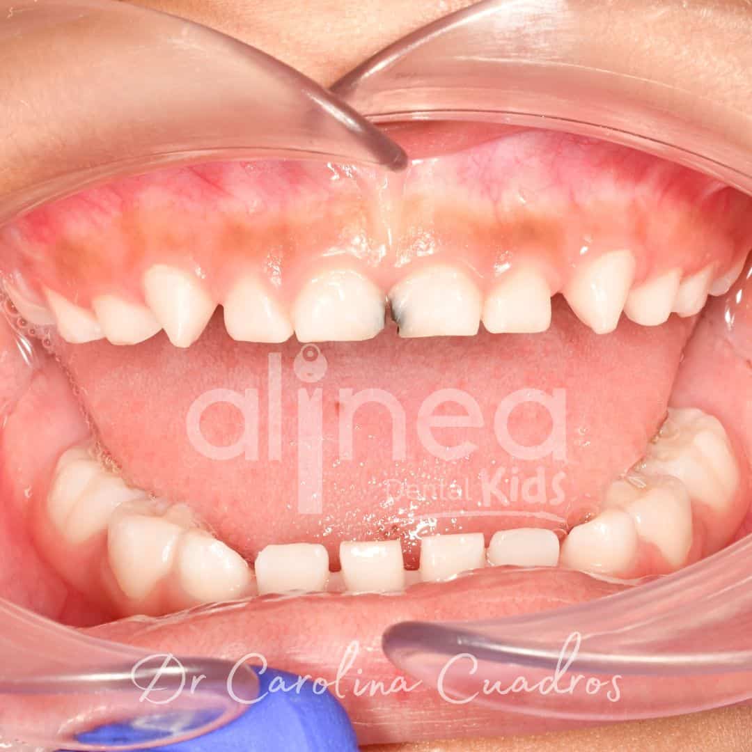 Dentista para niños