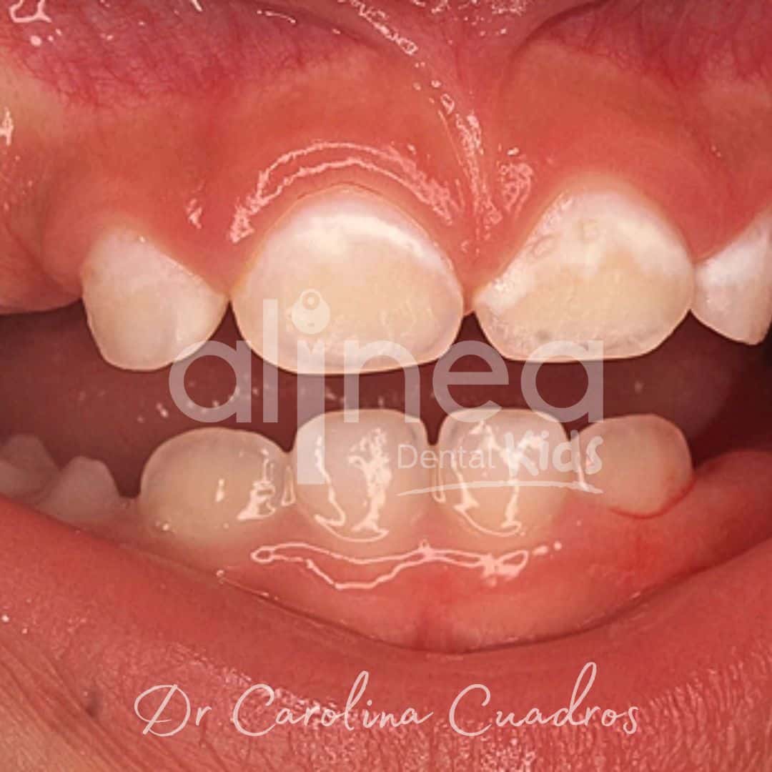 Dentista para niñosn en Lima