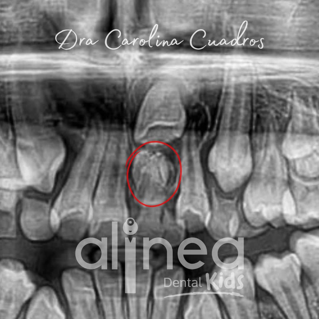 Odontopediatría