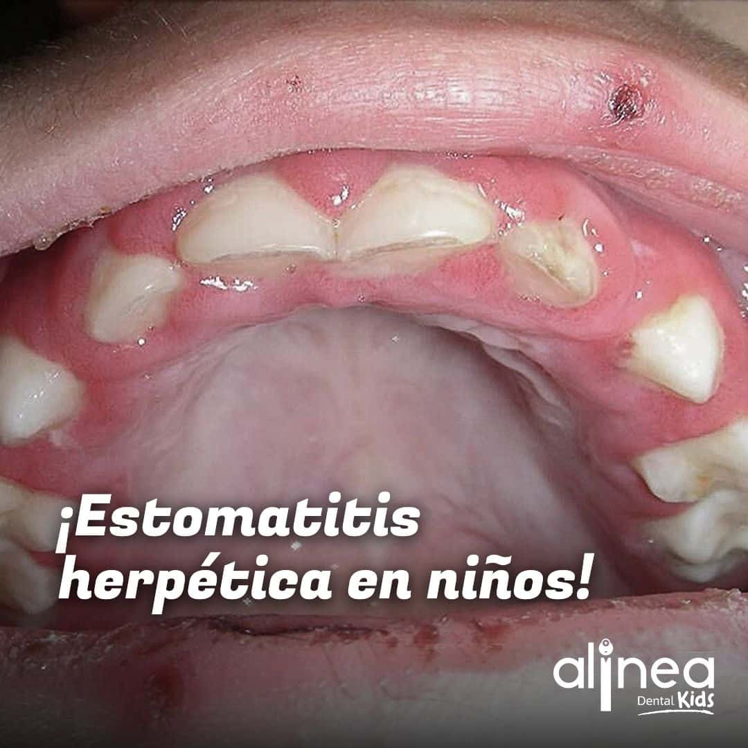 Dentista para niños en Lima