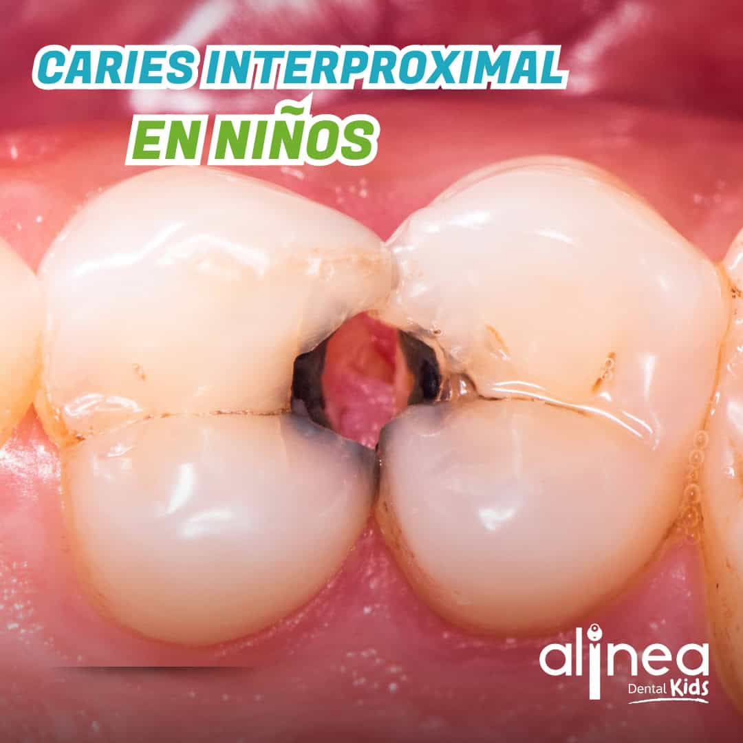 Dentista para niños