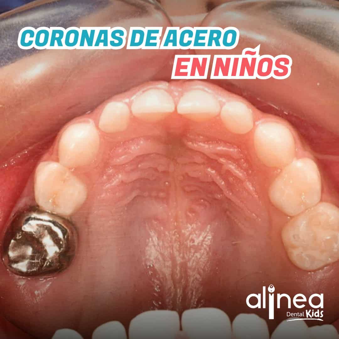 Dentista para niños