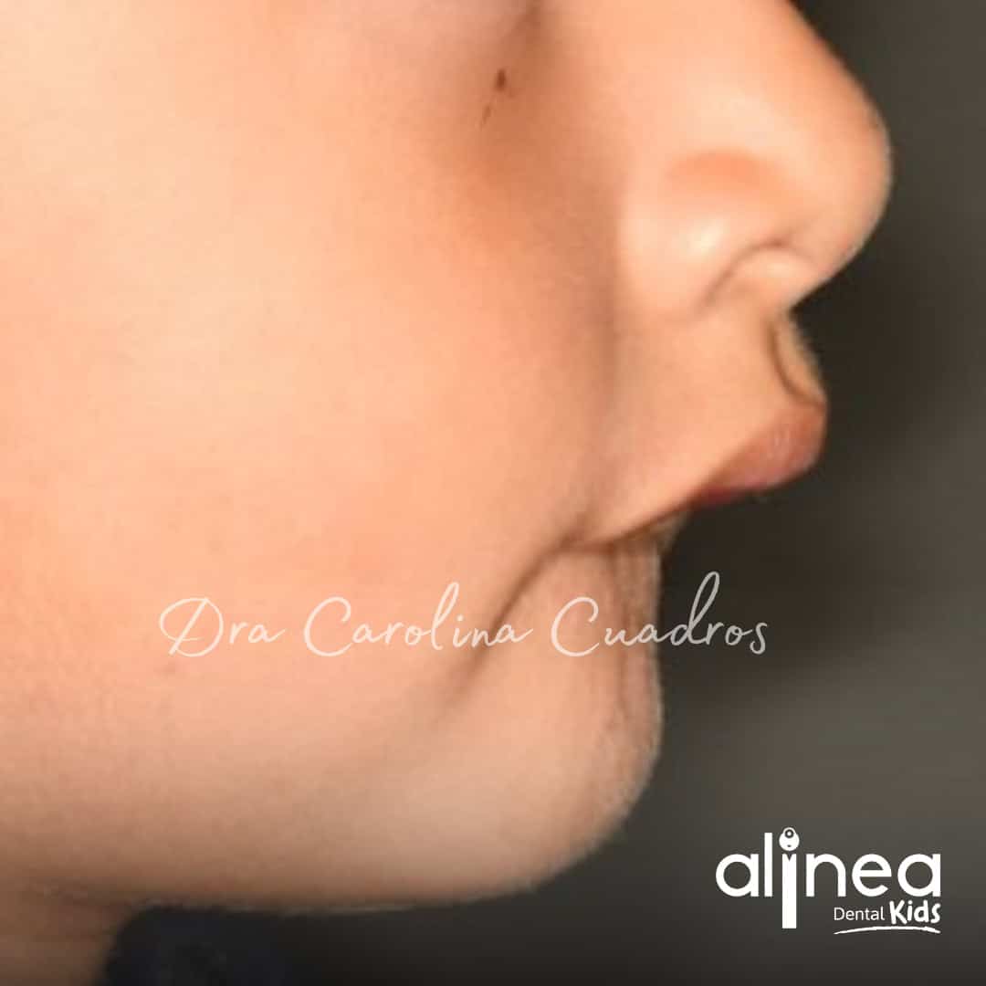 Dentista para niños