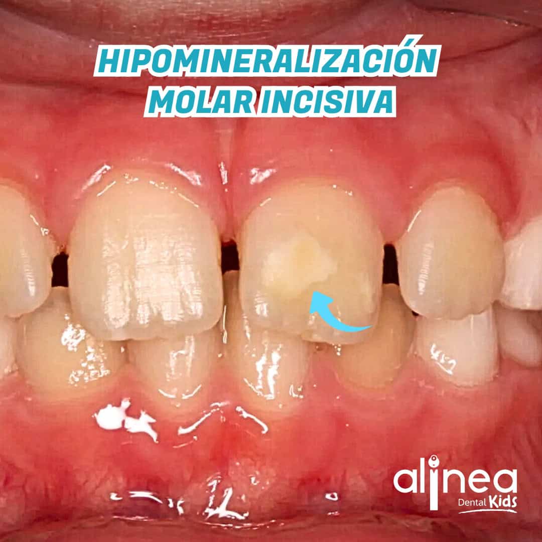 Odontopediatría