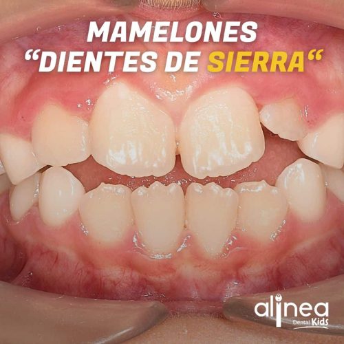 Dentista para niños
