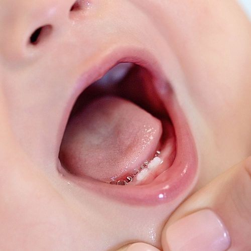 Dentista para niños