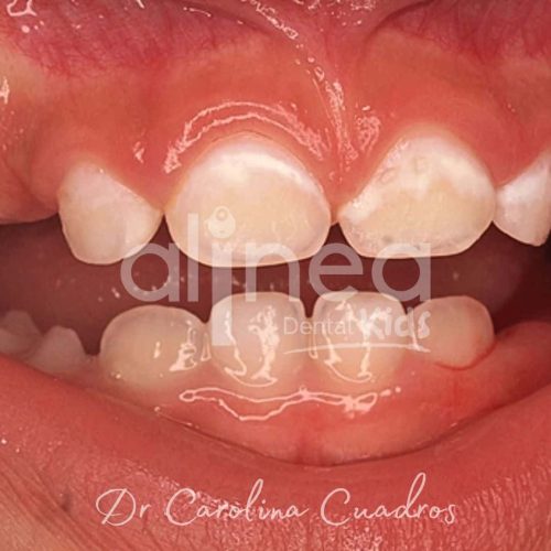 Dentista para niñosn en Lima