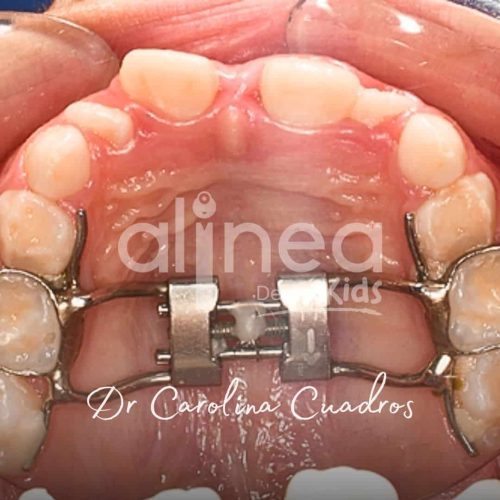 Dentista para niños