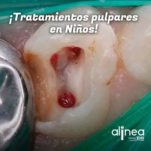 Odontopediatra