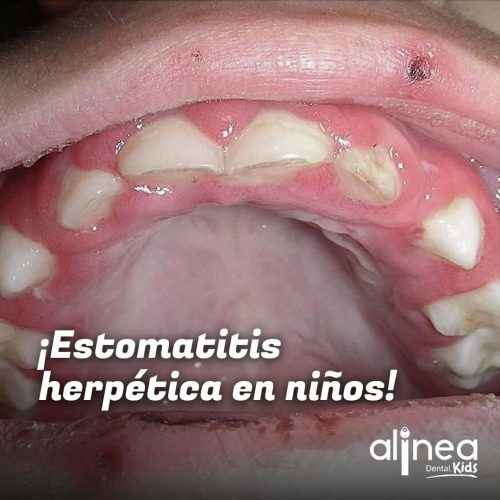 Dentista para niños en Lima